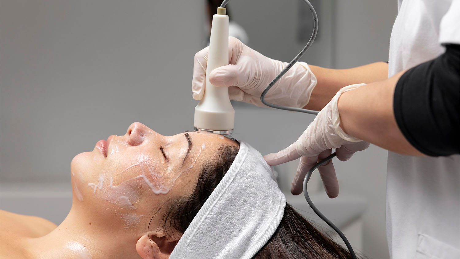 Microneedling
